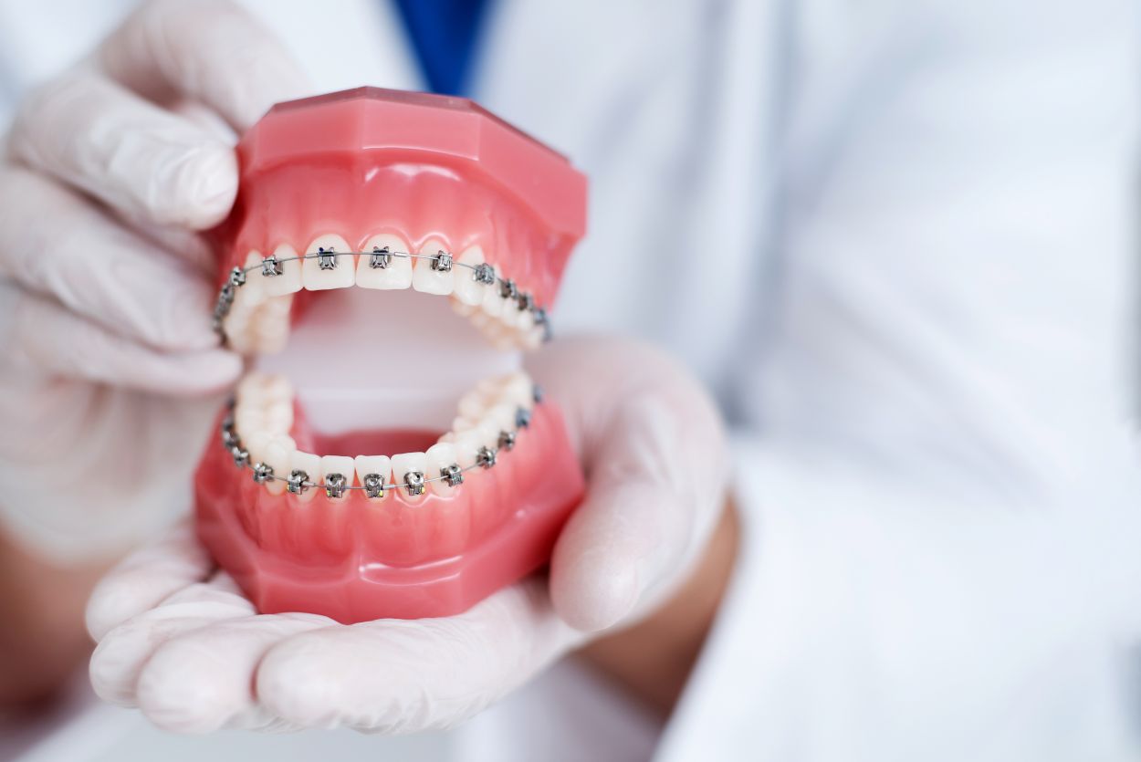 Alimentation et appareil orthodontique